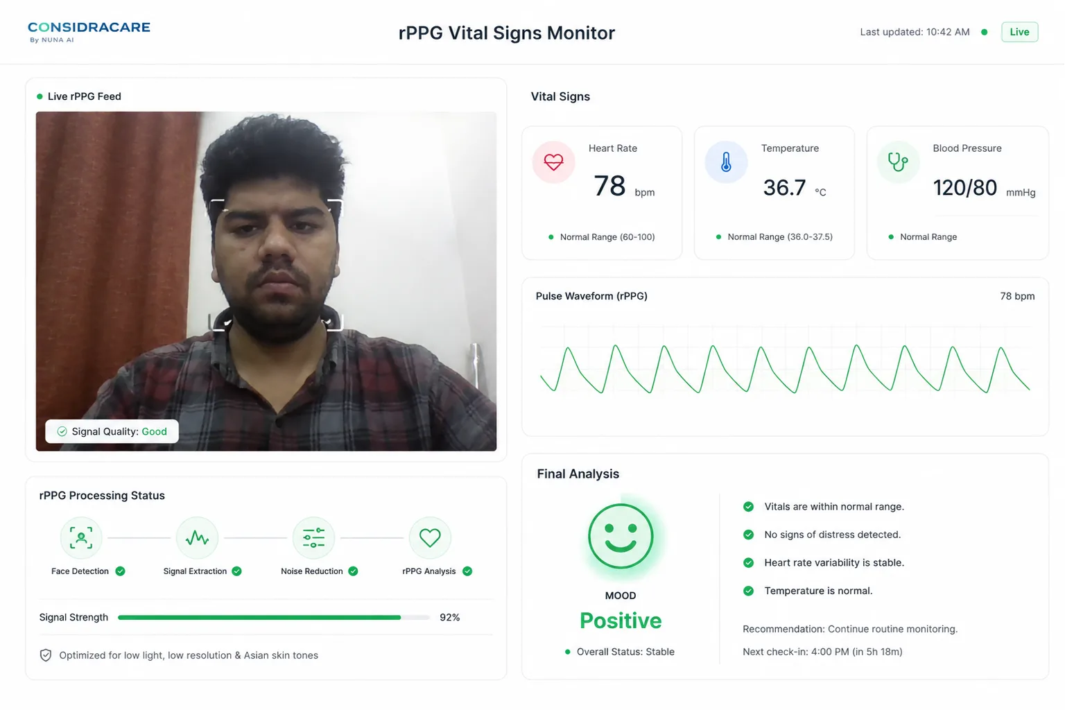 rPPG contactless vitals monitor